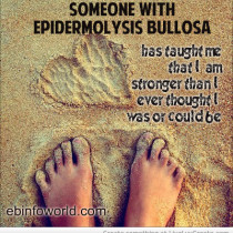 epidermolysis_bullosa_awareness-685400-210x210